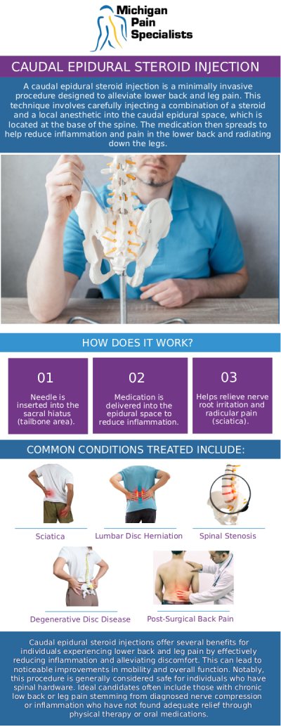 Common questions asked by clients: What is a caudal epidural steroid injection? How long does it take to recover from a caudal epidural steroid injection? Who is a good candidate for a caudal epidural steroid injection? How can specialists at Michigan Pain Specialists help with caudal epidural steroid injections? For more information, contact us or request an appointment online. We are conveniently located at 770 Riverside Ave suite 207, Adrian, MI 49221. We serve patients from Adrian MI, Tecumseh MI, Blissfield MI, Britton MI, and surrounding areas.