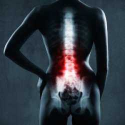 Caudal Epidural Steroid Injection in Ann Arbor, MI and Adrian, MI