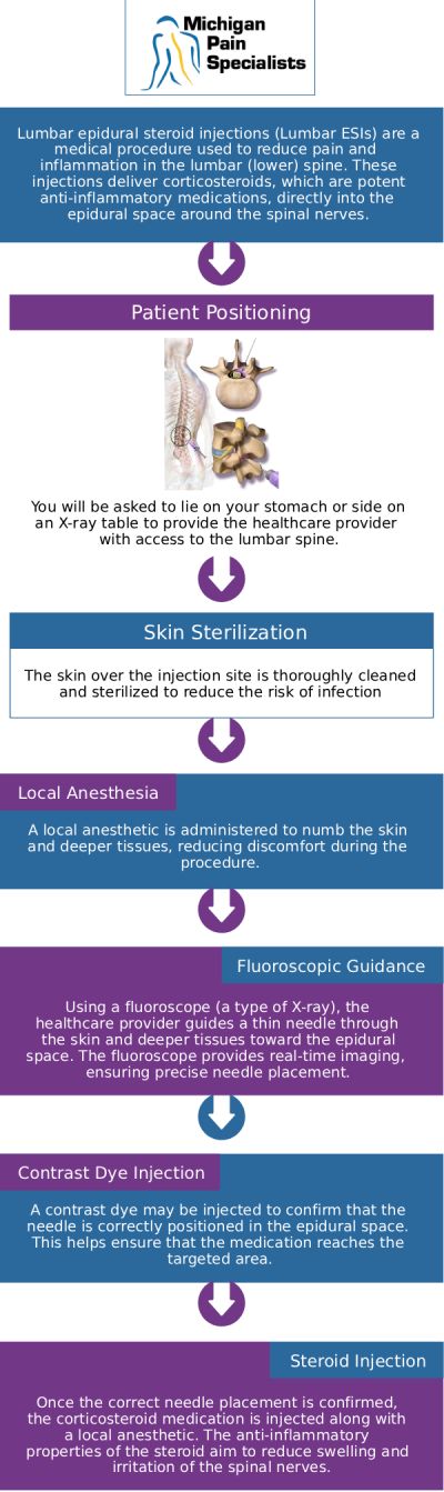 Common questions asked by clients: What is a lumbar epidural steroid injection, and how does it work? Are lumbar epidural steroid injections safe? What are the benefits of lumbar epidural steroid injections compared to surgery? How can our board-certified doctors help with lumbar epidural steroid injections at Michigan Pain Specialists? For more information, contact us or request an appointment online. We are conveniently located at 710 Avis Dr #200, Ann Arbor, MI 48108. We serve patients from Ann Arbor MI, Saline MI, Ypsilanti MI, Dexter MI, and surrounding areas.
