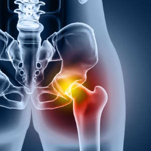 Hip Joint Injection in Adrian, MI and Ann Arbor, MI
