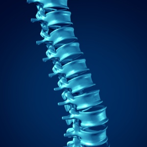 Kyphoplasty in Ann Arbor, MI and Adrian, MI