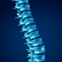 Kyphoplasty in Ann Arbor, MI and Adrian, MI