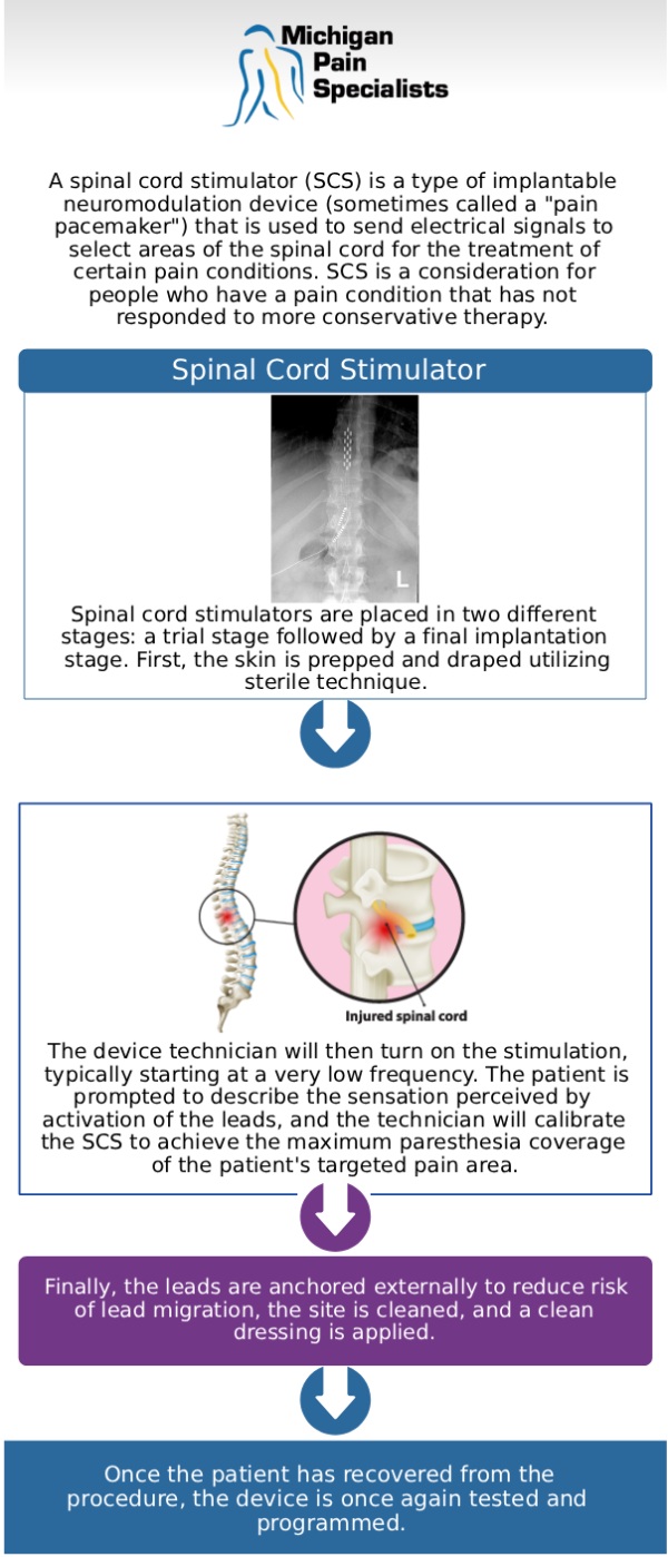 Spinal cord stimulation is an advanced, minimally invasive treatment designed to help manage chronic pain by altering pain signals before they reach the brain. A small device is implanted to deliver gentle electrical impulses to the spinal cord, helping reduce discomfort. This approach is often considered for ongoing back or nerve-related pain that has not improved with other treatments. At Michigan Pain Specialists, our board-certified doctors, Dr. Louis Bojrab, MD, FIPP, Dr. John Chatas, MD, FIPP, and Dr. Edward Washabaugh, MD, FIPP, provide personalized spinal cord stimulation care to support long-term relief and improved function. For more information, contact us or schedule an appointment online. We are conveniently located at 710 Avis Dr #200, Ann Arbor, MI 48108. 
