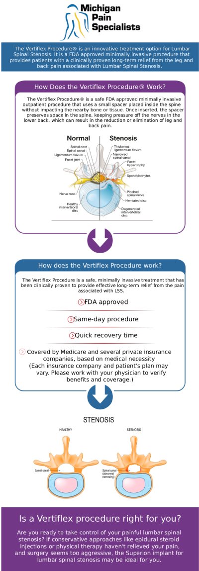 Common questions asked by clients: What is the Vertiflex procedure? How does the Vertiflex procedure relieve spinal stenosis pain? Who is a good candidate for the Vertiflex procedure? How long does recovery take after a Vertiflex implant? Insights from Our Board-Certified Doctors. For more information, contact us or request an appointment online. We are conveniently located at 710 Avis Dr #200, Ann Arbor, MI 48108. We serve patients from Ann Arbor MI, Saline MI, Ypsilanti MI, Dexter MI, and surrounding areas.
