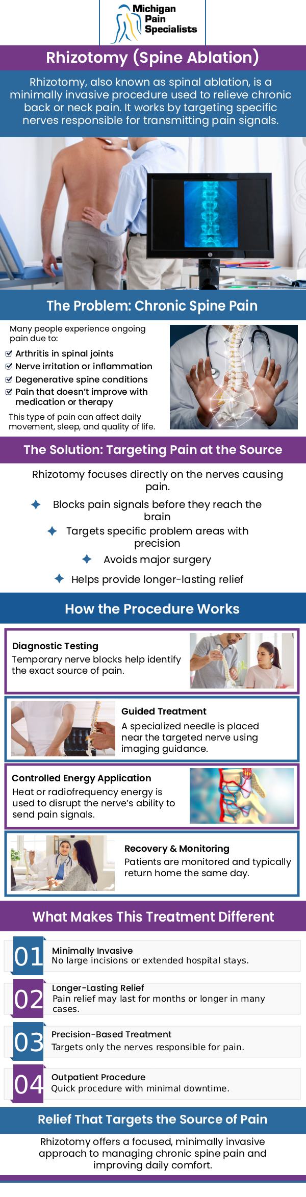 Rhizotomy ablation treatment is a minimally invasive procedure used to reduce chronic pain by targeting specific nerve signals. It works by using heat or radiofrequency energy to disrupt pain transmission from affected nerves. This treatment is often recommended for conditions involving the spine, such as facet joint pain or chronic back discomfort. At Michigan Pain Specialists, our board-certified doctors, Dr. Louis Bojrab, MD, FIPP, Dr. John Chatas, MD, FIPP, and Dr. Edward Washabaugh, MD, FIPP, provide personalized rhizotomy ablation care to help improve comfort and daily function. For more information, contact us or schedule an appointment online. We are conveniently located at 710 Avis Dr #200, Ann Arbor, MI 48108.